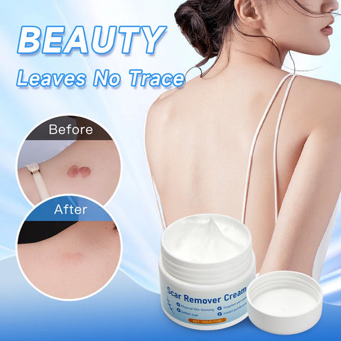 removes stretch marks acne marks Burn surgery scars Fade scars Smooth