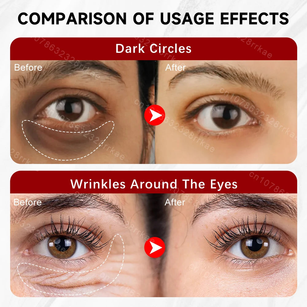 Dark circles eye wrinkles Eye cream