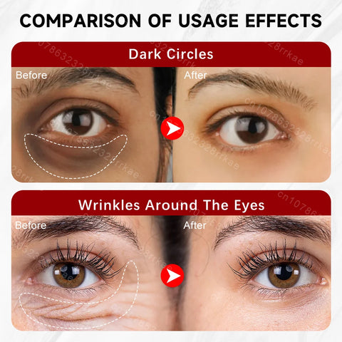 Eye cream removes eye bags puffiness dark circles eye wrinkles, Fade Eye Fine Line,  Anti Wrinkle whitens skin care