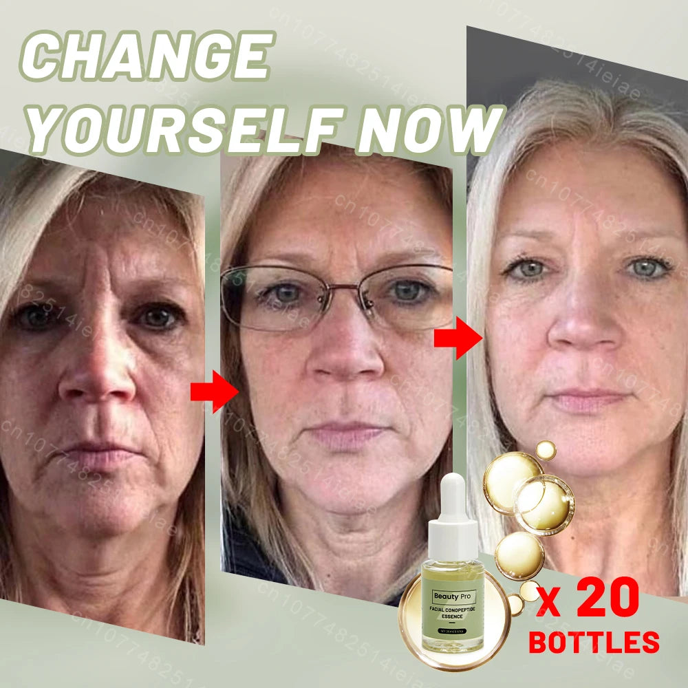 wrinkle removal essence anti aging serum