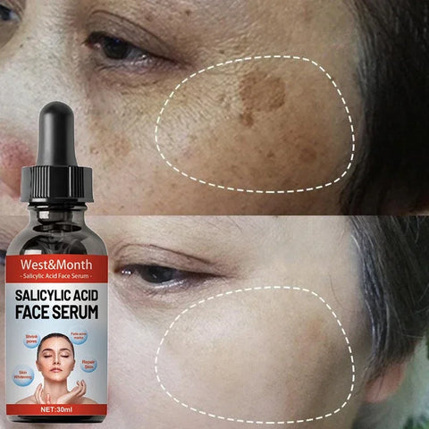 30ml Salicylic Acid Facial Serum