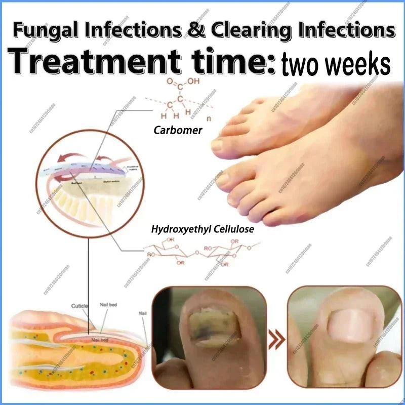 Foot Care Nail Repair Treatment