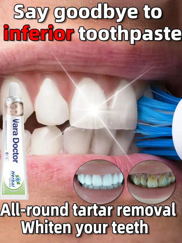 remover dental calculus whitening teeth mouth odor removal bad breath Preventing Periodontitis