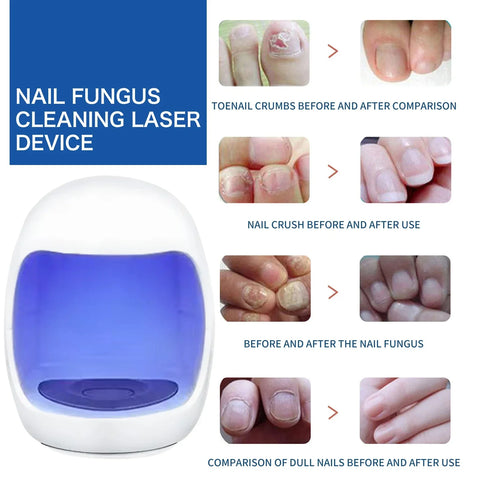 Fungus Nail Laser Device Fast Nail Fungus Repair Ingrown Toenails Foot Care