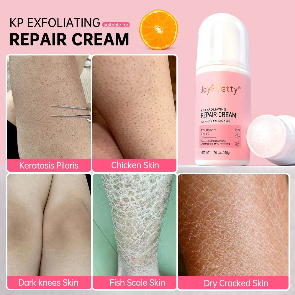 Body Cream Chicken Skin Removal Treatment