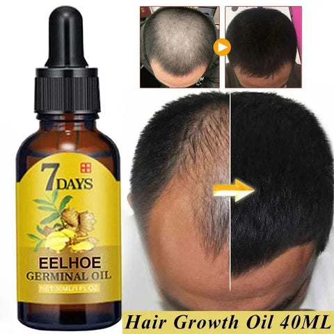 Authentic Hair Loss Liquid Health Care Beauty Dense Hairs Growth Serum