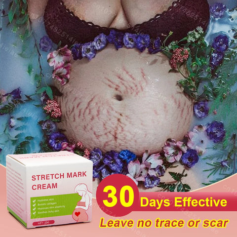 Pregnancy Mark Removal Cream