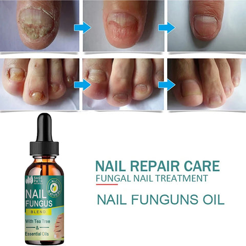 Nail Fungus Treatment Essential Oils