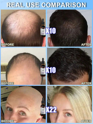 Adenosine Hair Growth Essence