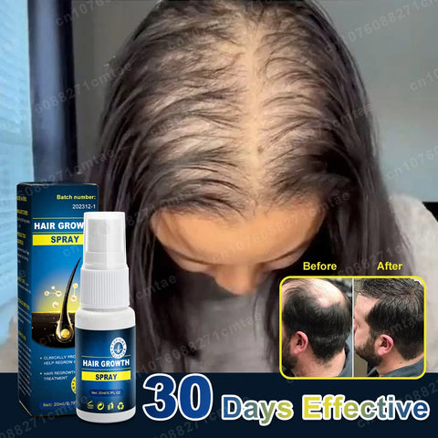 Hair Growth Spray for Men Women