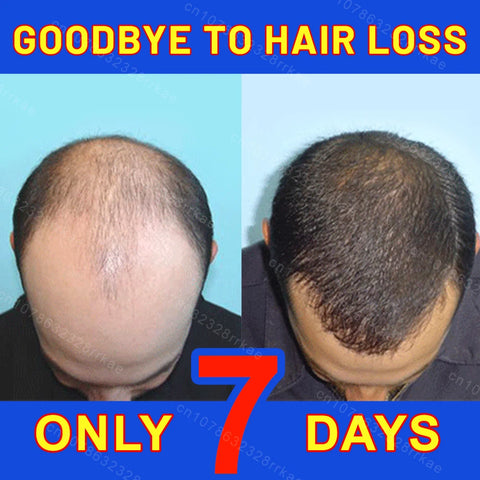 Hair growth products Fast Hair Growth Hair care