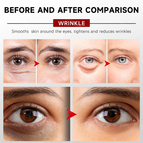 Dark circles eye wrinkles Eye cream