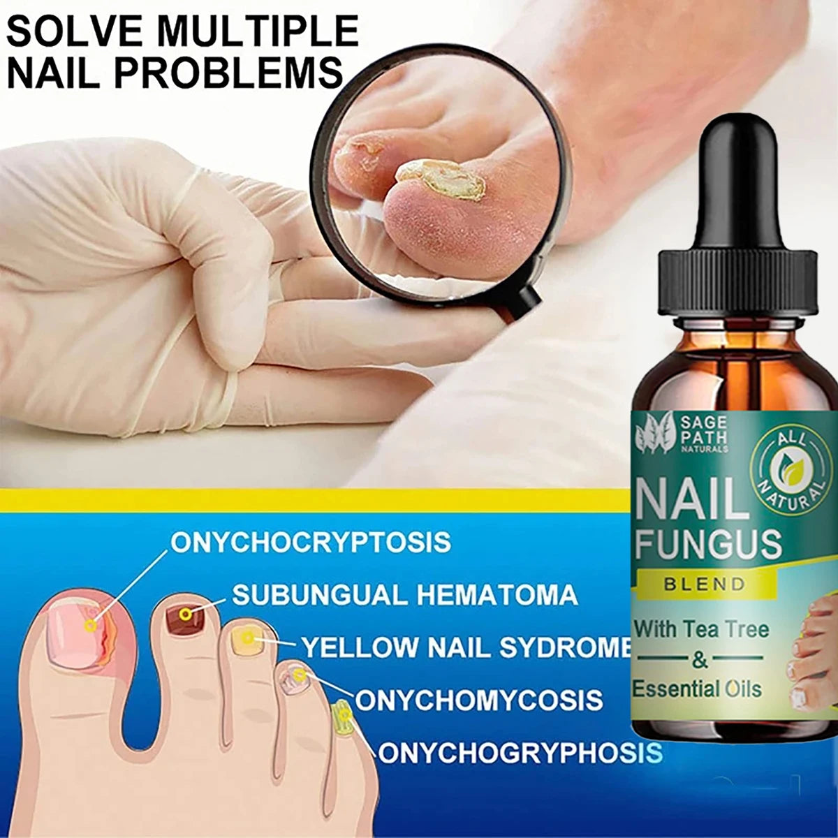 Nail Fungus Treatment Essential Oils