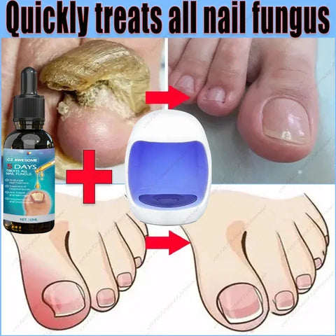 Foot Care Nail Repair Treatment