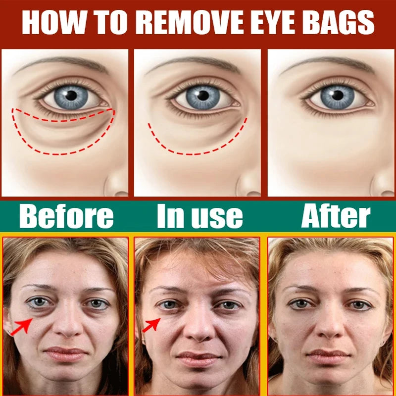 Eyes Bag Remove Collagen Eye Patch Instant Fade Fine Lines