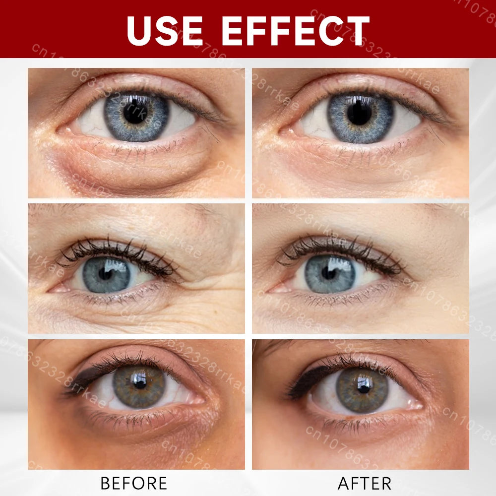 Dark circles eye wrinkles Eye cream