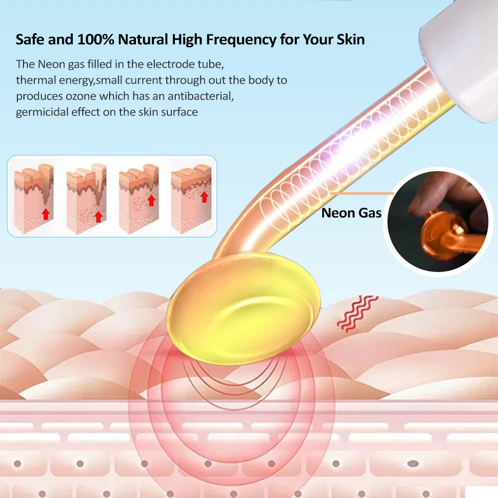 High Frequency Wand Portable Facial Electrotherapy