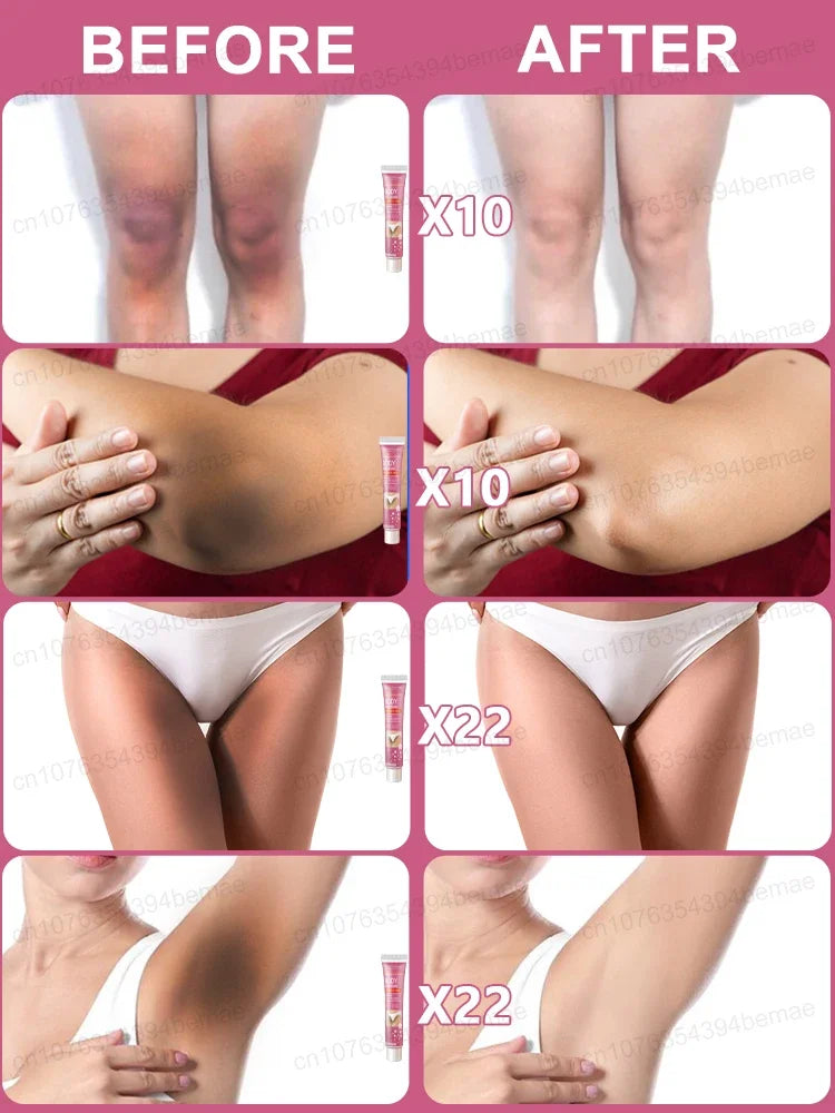 Body Whitening Cream Removal Moisture Private Parts Care Safe For Women Men