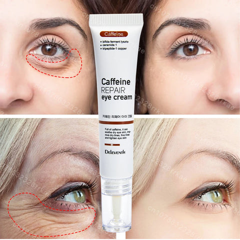 Eye cream removes eye bags puffiness dark circles eye wrinkles, Fade Eye Fine Line,  Anti Wrinkle whitens skin care