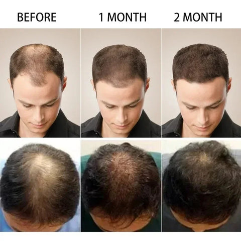 Authentic Hair Loss Liquid Health Care Beauty Dense Hairs Growth Serum