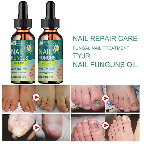 Nail Fungus Treatment Essential Oils