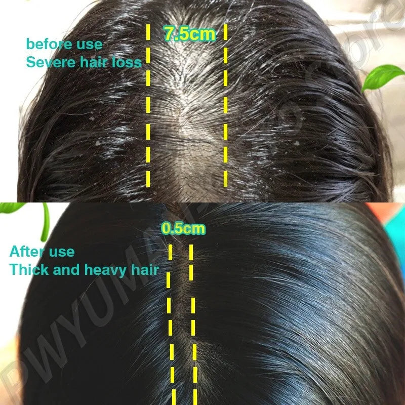 Anti Hair Loss Serum Liquid Scalp Damaged Treatment Repair