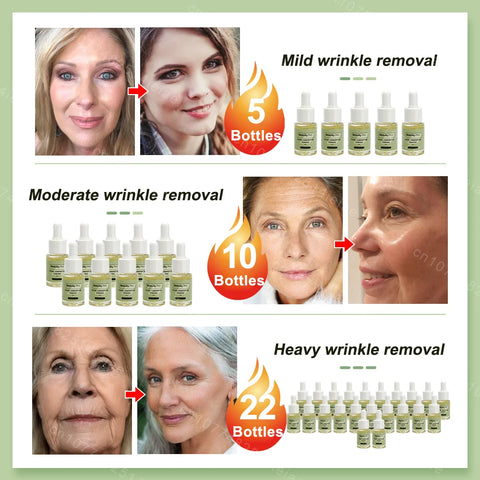 wrinkle removal essence anti aging serum