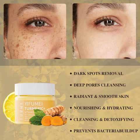 Turmeric Vitamin C Face Cream Acne Treatment Dark Spots Removal Moisturizing Brightening Whitening Cream Skin Lightening Care